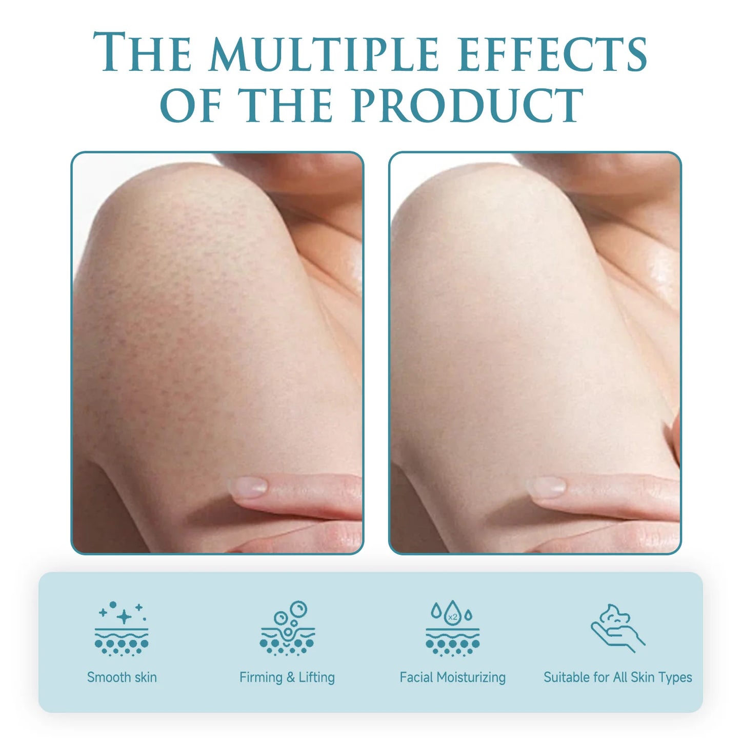 Niacinamide Body Anti-wrinkle Cream Anti-wrinkle Moisturizing Nourishing Body Lotion Lighten Fine Lines Women's Skin Care Produc