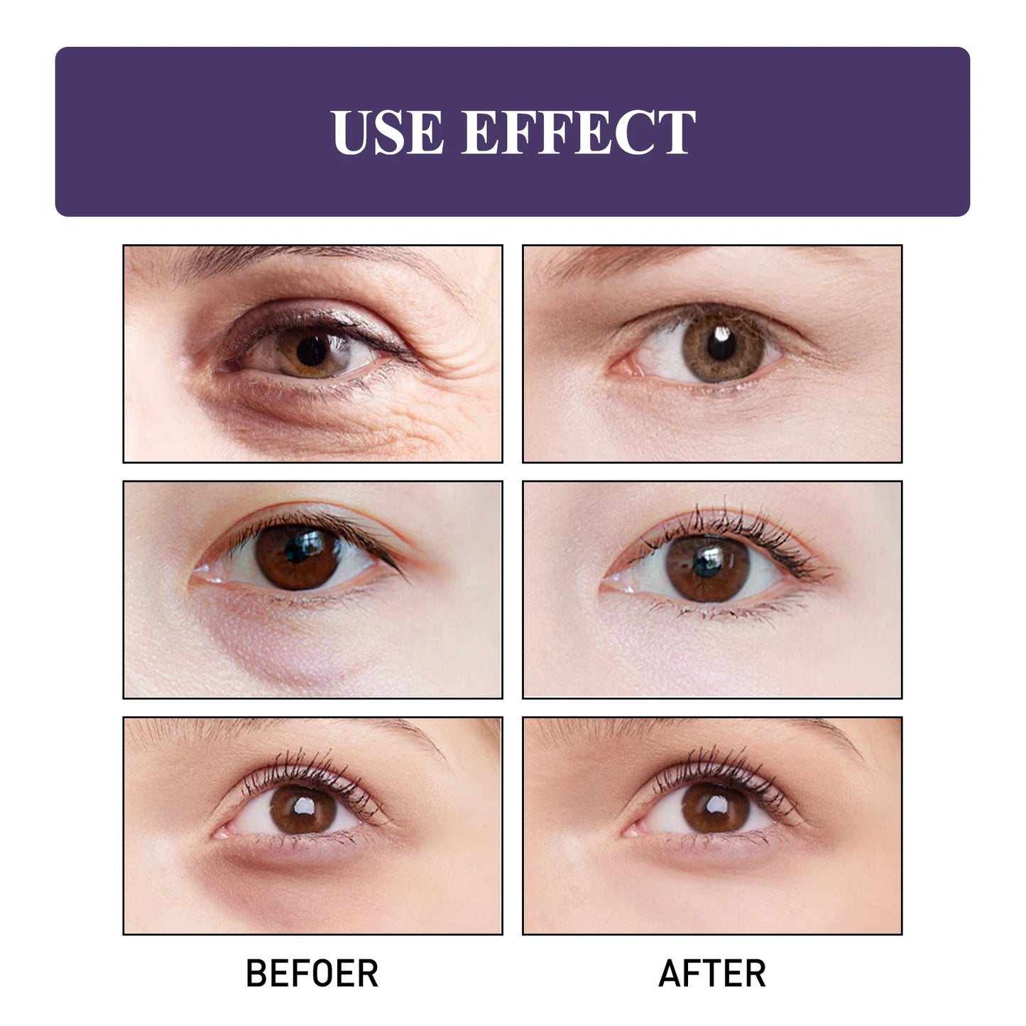 Niacinamide Eye Cream Lightens Dark Circles Tightens Skin, Instant Eye Repair Essence Stick, Women's Eye Care Products