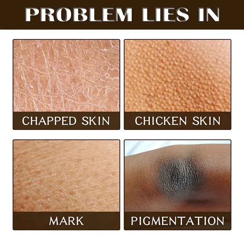 Coffee Body Scrub Cream Exfoliating Bleach Elbow Underarm Knee Melanin Pigmentation Whitening Remove Dead Skin Shower Scrub Care