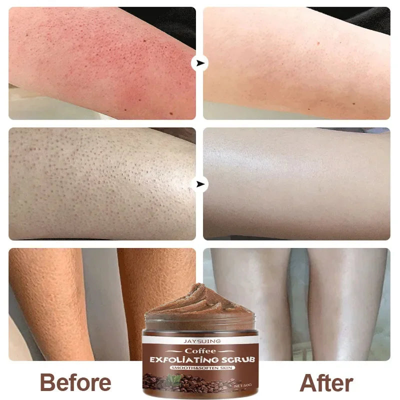 Coffee Body Scrub Cream Exfoliating Bleach Elbow Underarm Knee Melanin Pigmentation Whitening Remove Dead Skin Shower Scrub Care