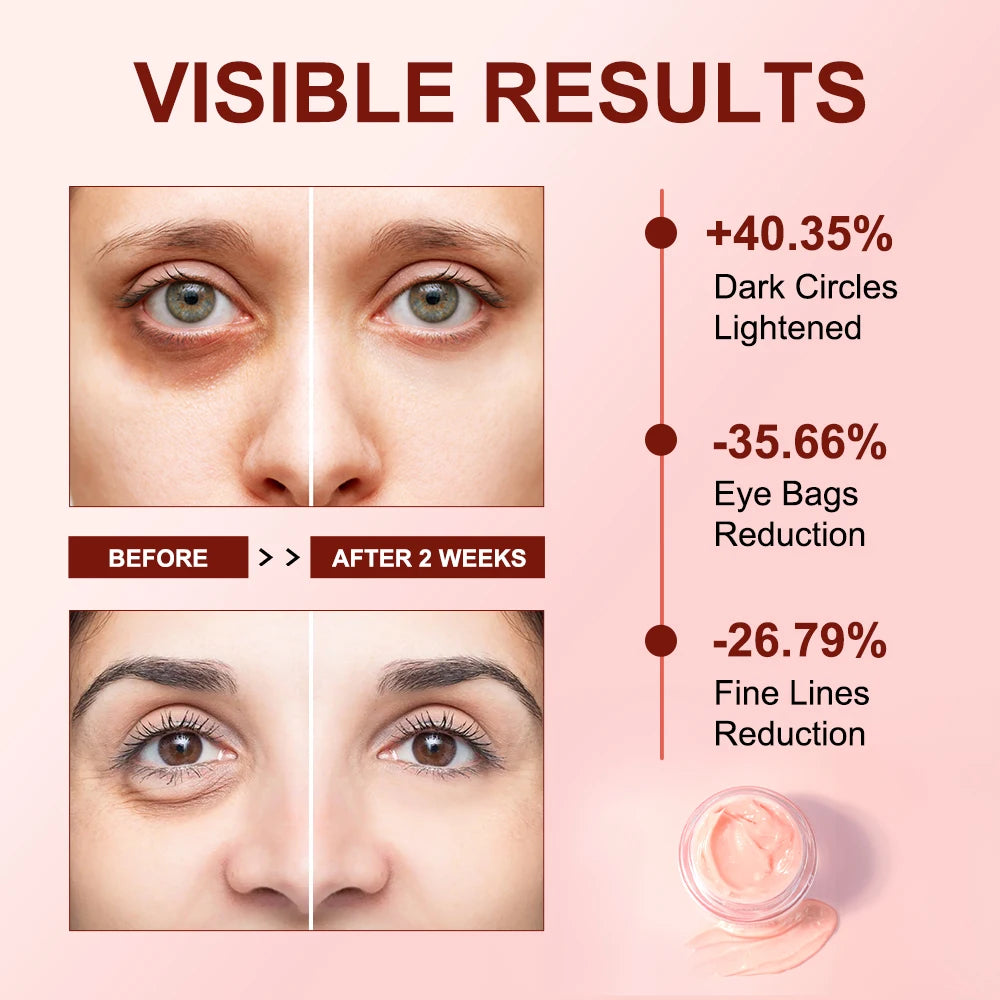 Anti Dark Circle Eye Cream Caffeine Whitening Moisturizing Wrinkle Remover Cream Eyes Bags Lifting Firming Skin Care Products