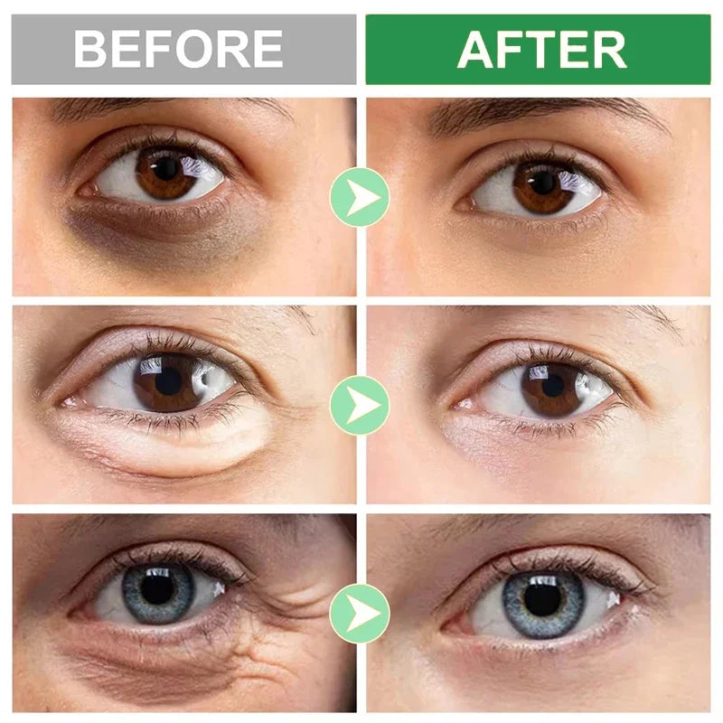 Peptide Anti Dark Circle Eye Cream Eye Bags Caffeine Anti-Wrinkle Massage Fine Lines Firm Whitening Cream Eyes Skin Care Beauty