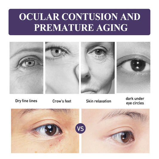Niacinamide Eye Cream Lightens Dark Circles Tightens Skin, Instant Eye Repair Essence Stick, Women's Eye Care Products