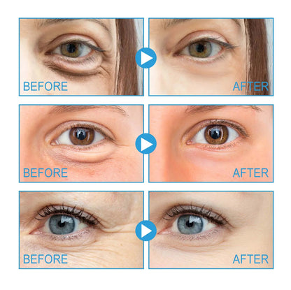 Caffeine Dark Circle Eye Cream Eye Bag Caffeine Lightens Wrinkles and Removes Fine Lines Firming and Brightening Cream Eye Area