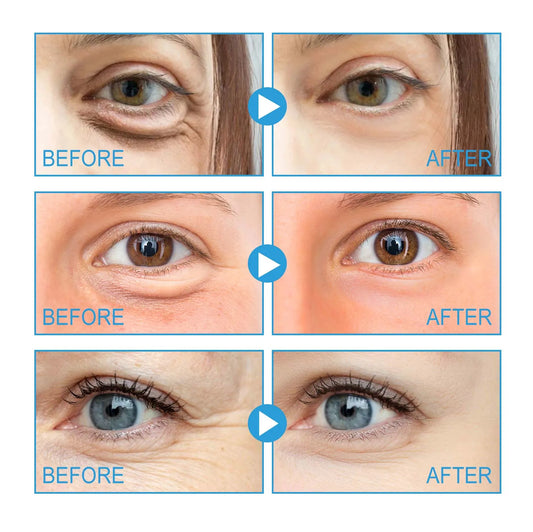 Caffeine Dark Circle Eye Cream Eye Bag Caffeine Lightens Wrinkles and Removes Fine Lines Firming and Brightening Cream Eye Area