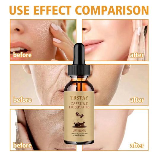 TRSTAY coffee eye lifting oil improves dry skin, fine lines, and tightens eye skin